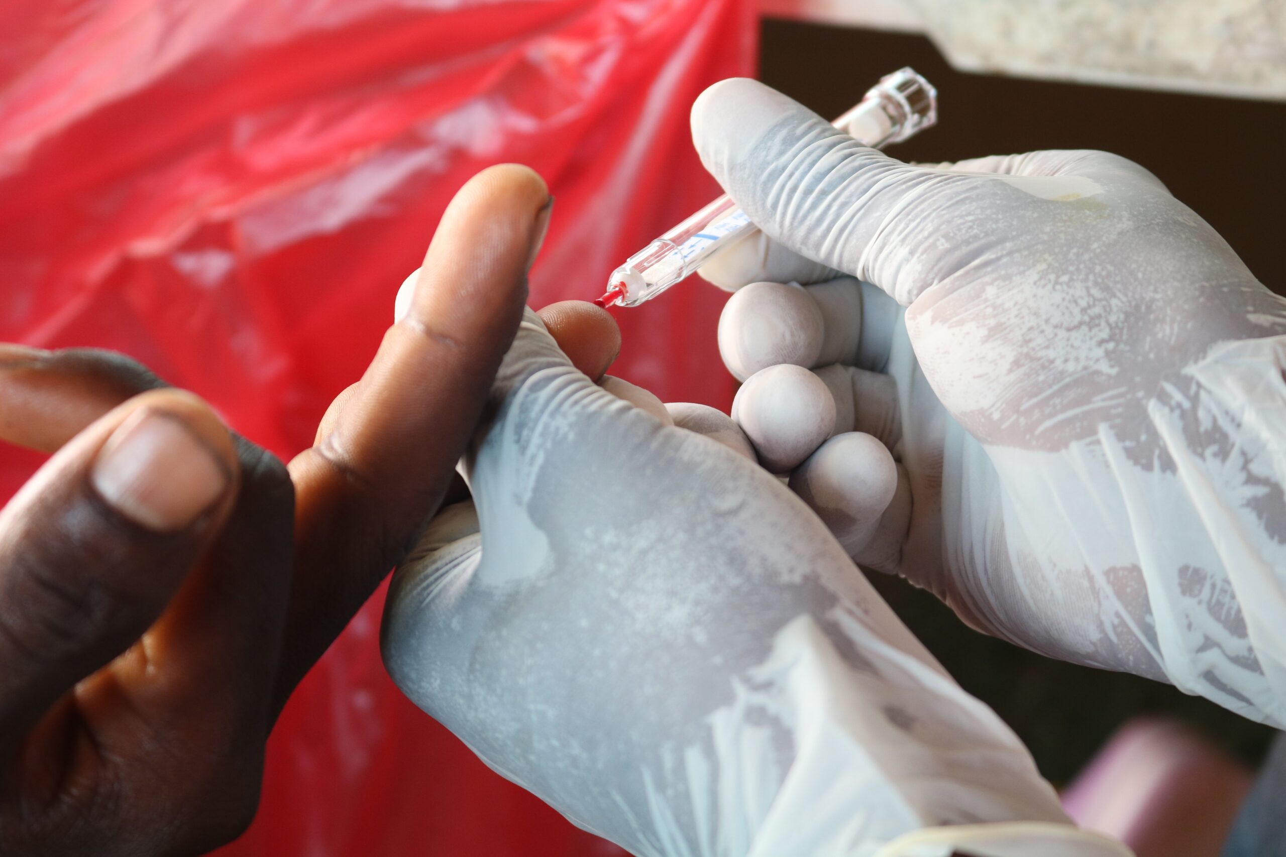 Provision of HIV testing services